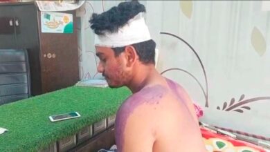 गिरफ्तारी में देरी: नामजद आरोपी अंकुर चौहान और अन्य की गिरफ्तारी अब तक क्यों नहीं हुई?